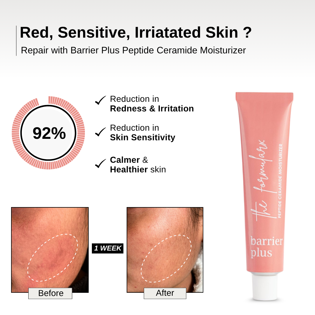 The Formularx Barrier Plus Peptide Ceramide Moisturizer for dry sensitive skin