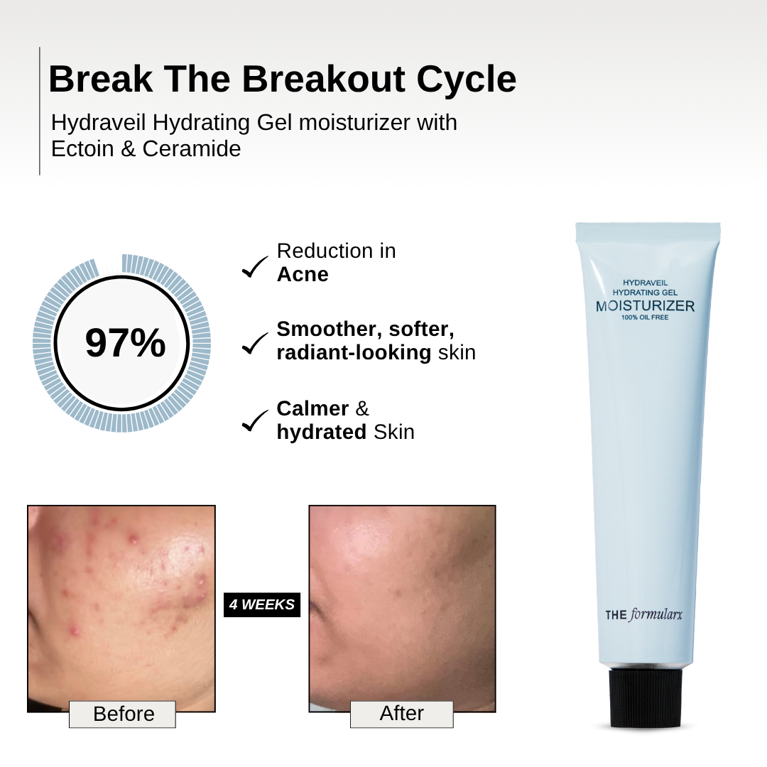 The Formularx Hydraveil Hydrating Ceramide Gel Moisturizer repairs damaged skin barrier, hydrates and reduce acne