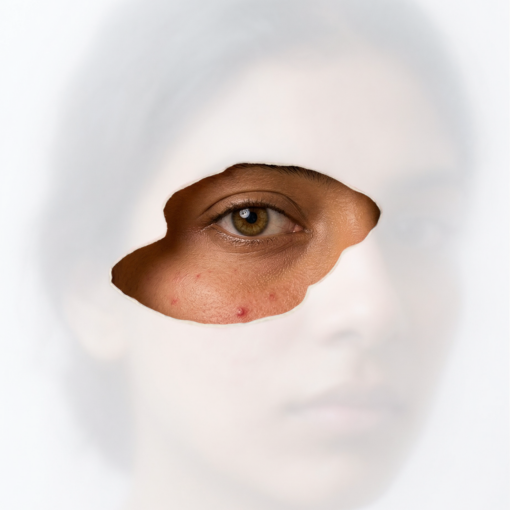 Damaged Skin Barrier? Here's How to Repair It