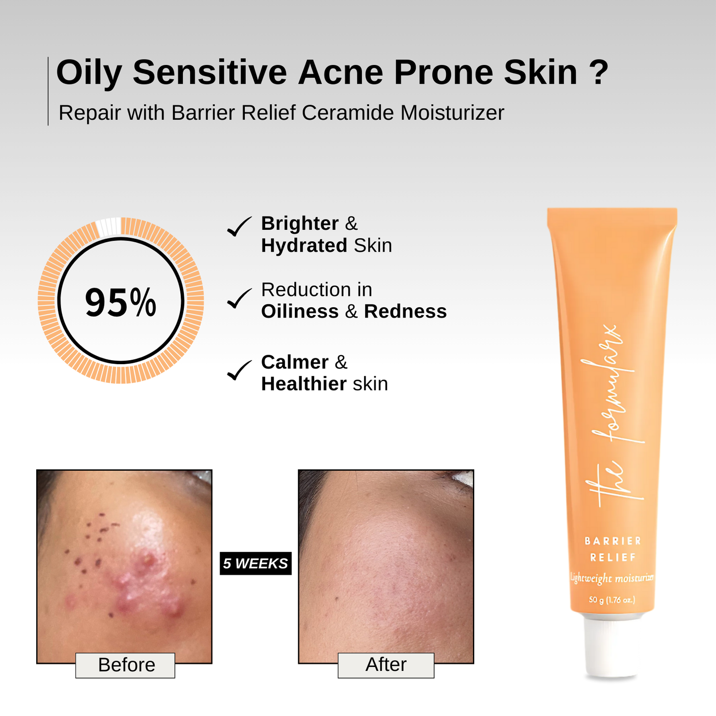 Barrier Relief Moisturizer + Sun Relief Sunscreen (Valentine Combo)