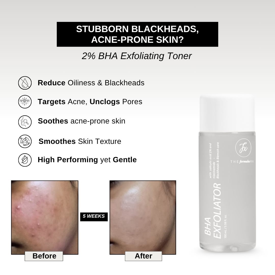 2% BHA Exfoliating Toner