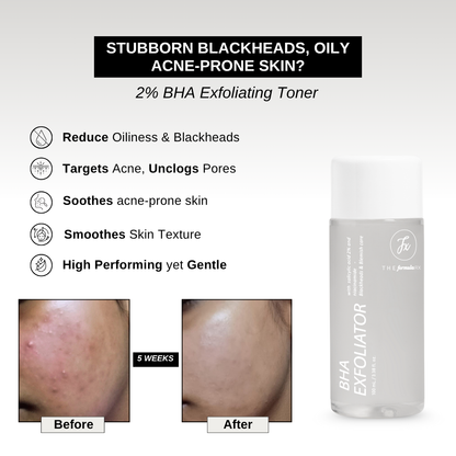 2% BHA Exfoliating Toner