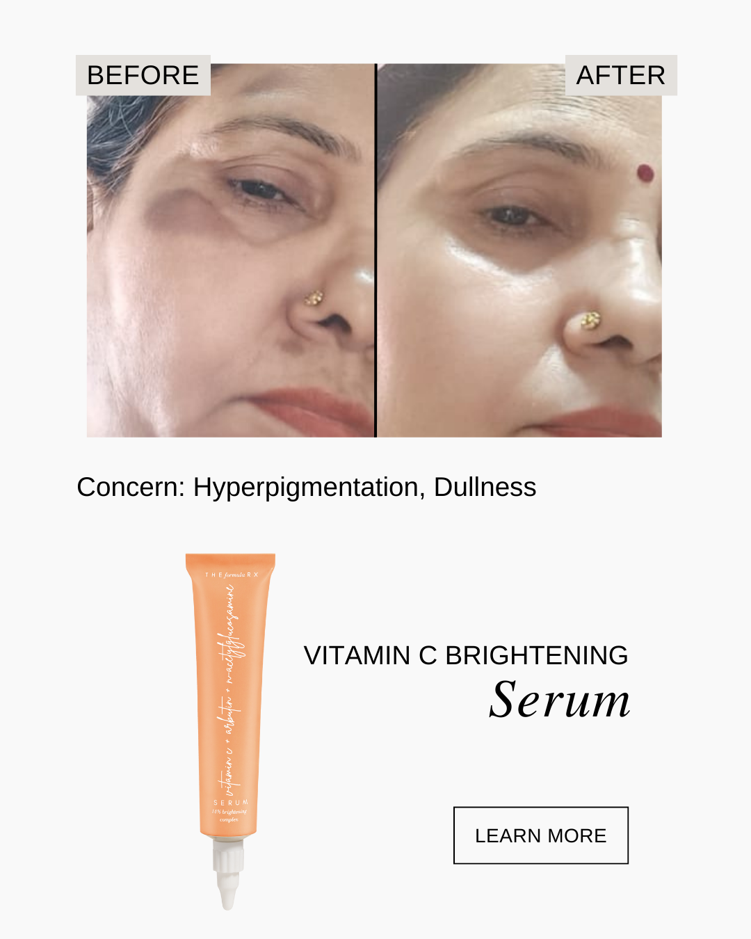 Formula Rx Sunscreen The Formularx Dermocosmetics - Barrier Focused for Sensitive skin – THE ...