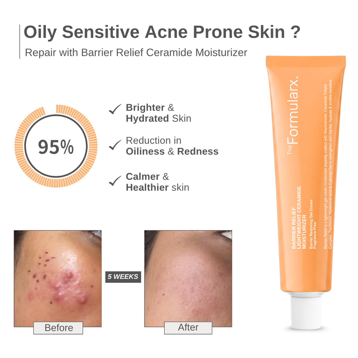Barrier Relief Lightweight Ceramide  Moisturizer