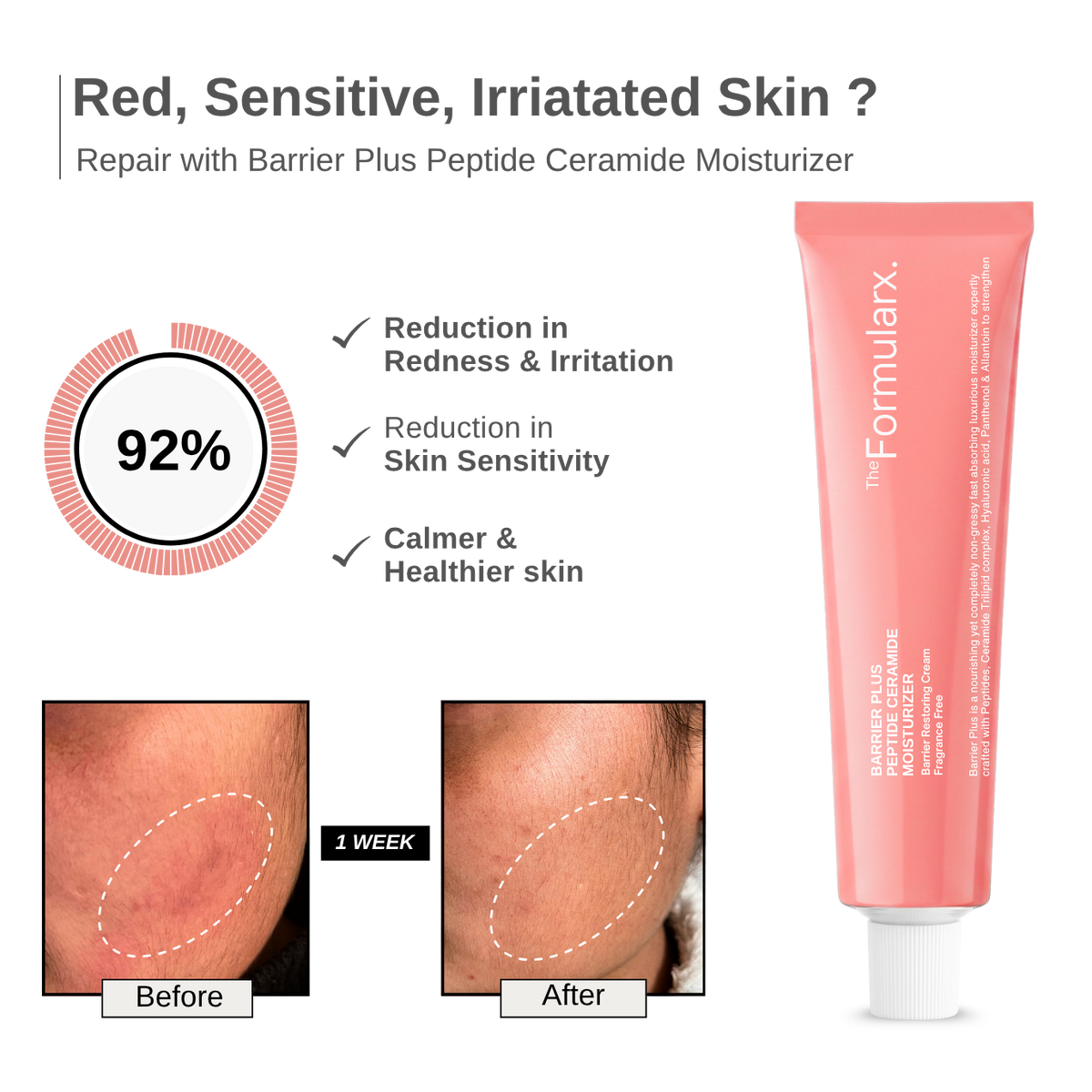 Barrier Plus Peptide Ceramide Moisturizer