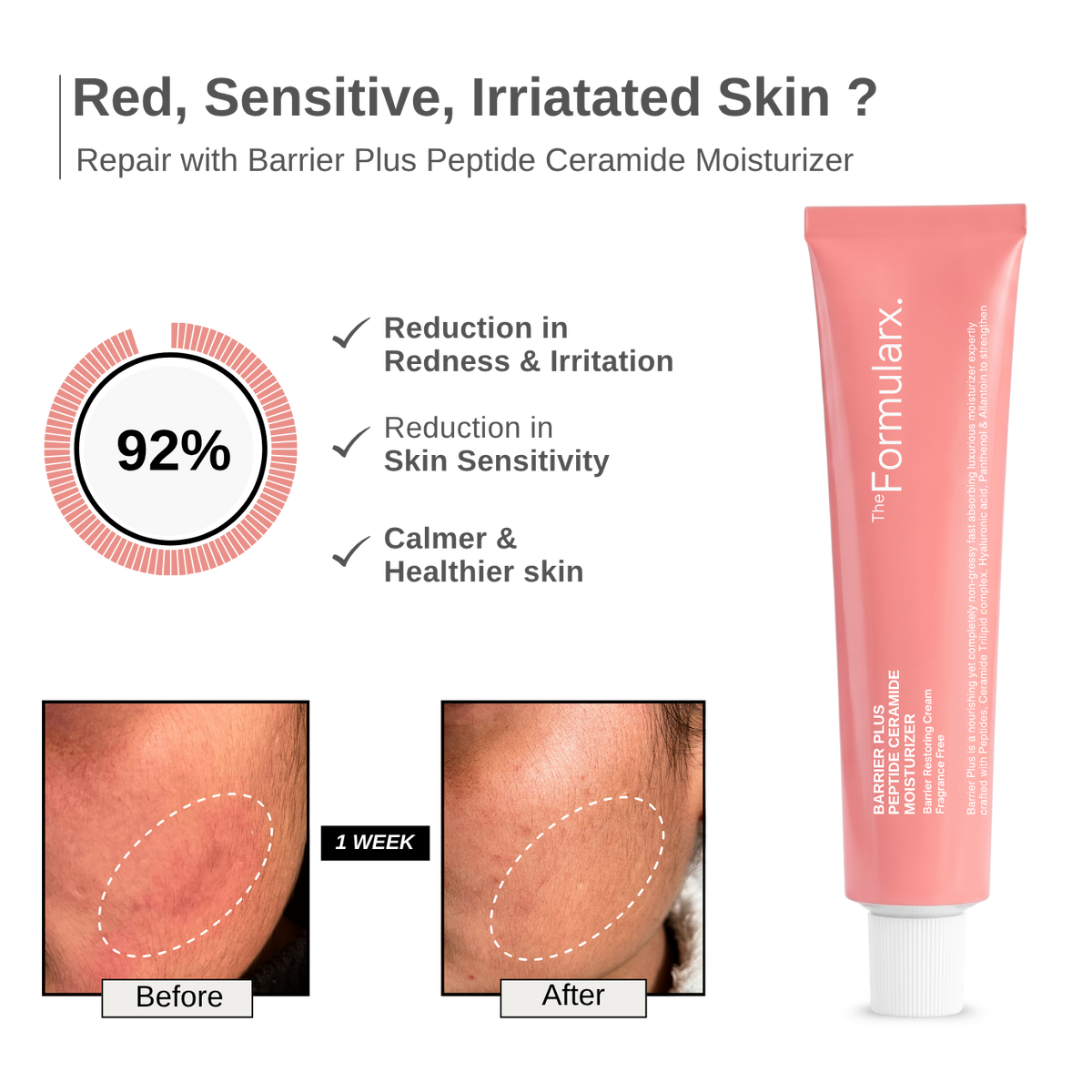 Barrier Plus Peptide Ceramide Moisturizer