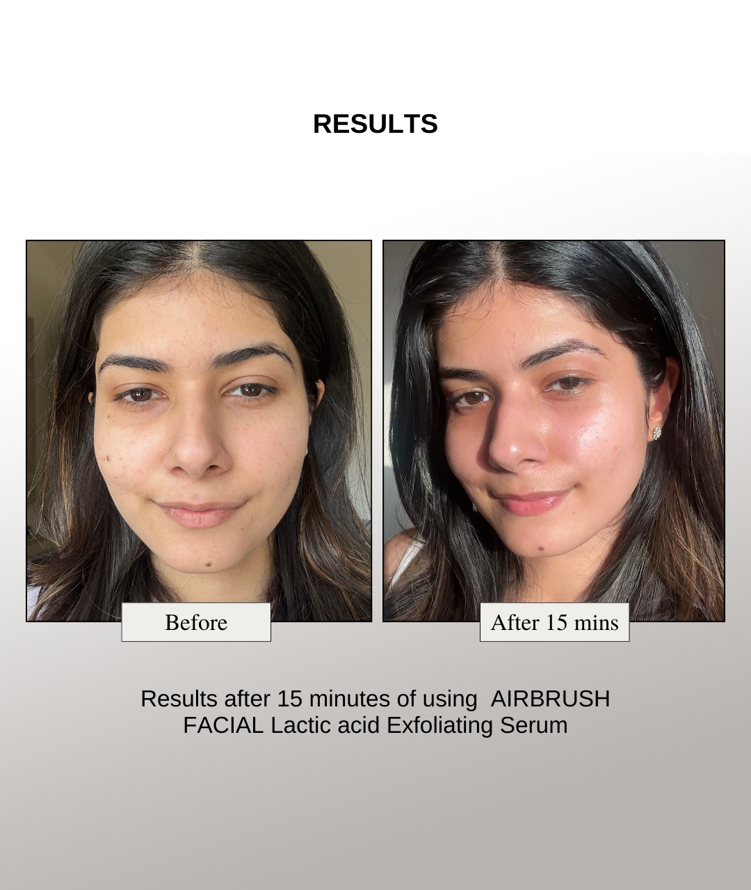 The Formularx air brush facial lactic acid serum results