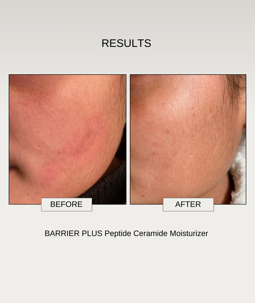 The Formularx Barrier Plus Peptide Ceramide Moisturizer results