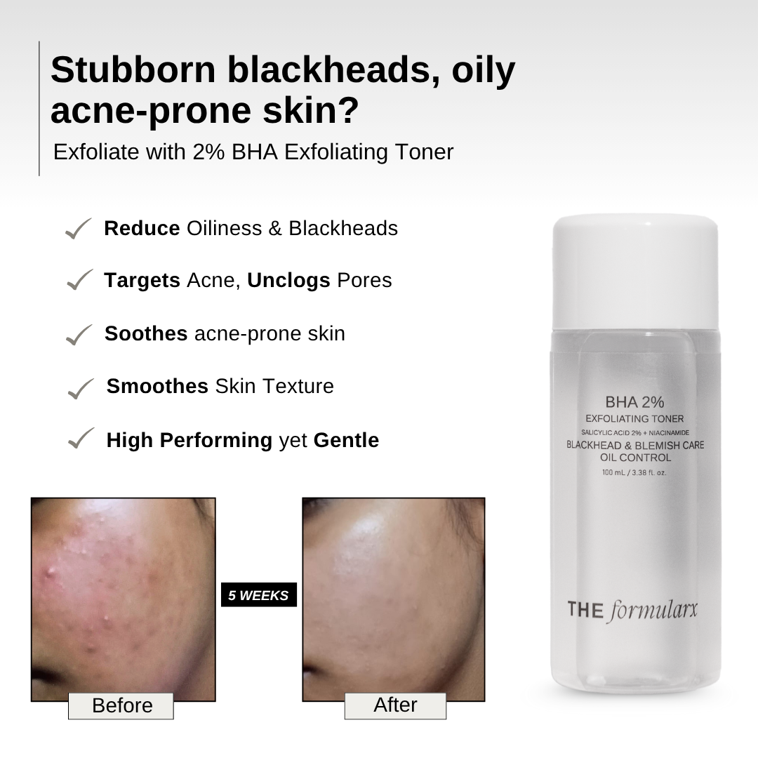 The Formularx 2% BHA Salicylic acid exfoliating toner with Niacinamide to reduce oiliness, acne, and enlarged pores