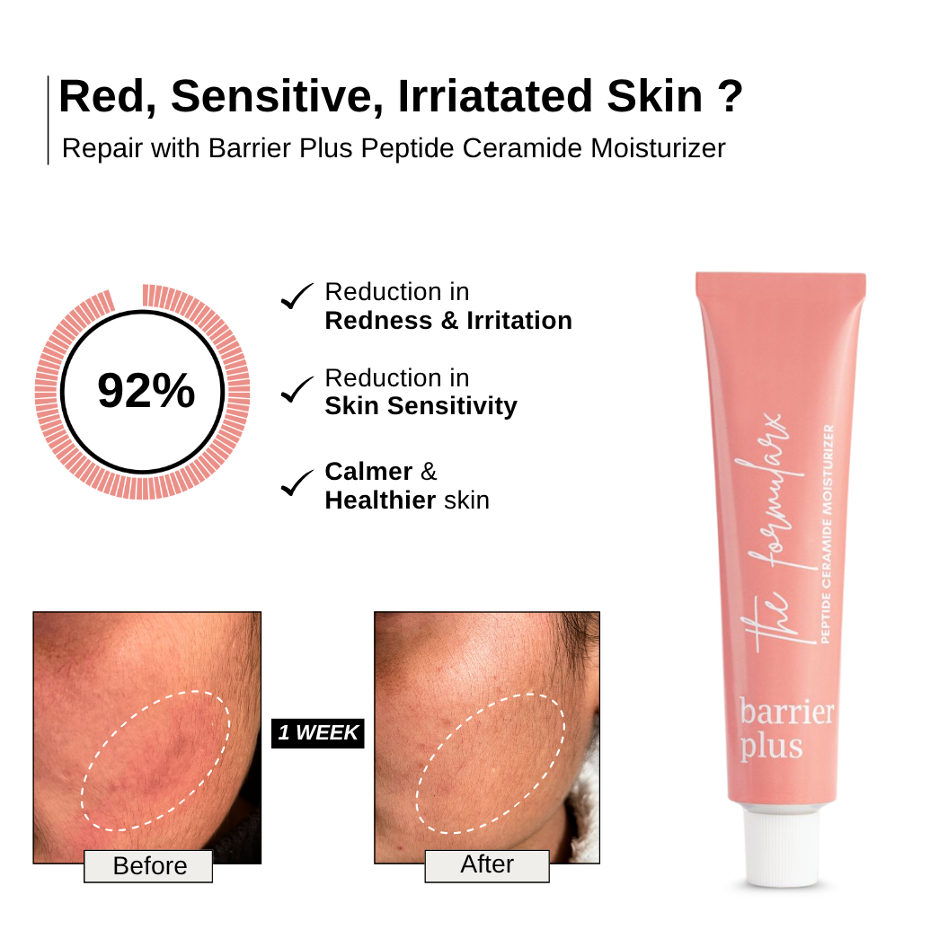 The Formularx Barrier Plus Peptide Ceramide Moisturizer Results