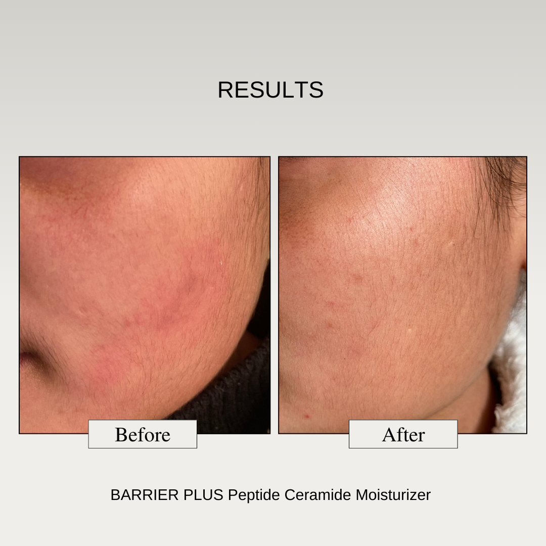 The Formularx Barrier Plus Peptide Ceramide Moisturizer results 