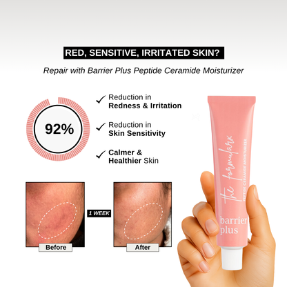 The Formularx Barrier Plus Peptide Ceramide Moisturizer to reduce skin sensitivity, redness, irritation, & itching