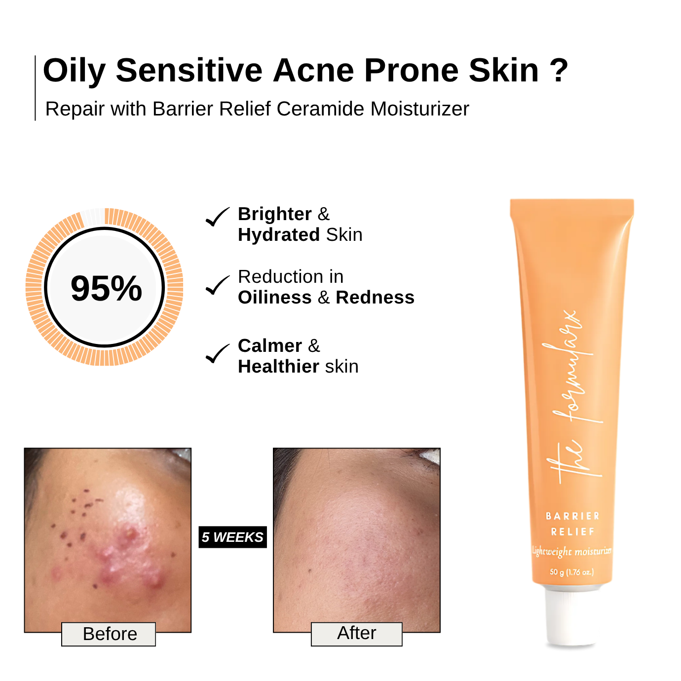 The_Formularx_Barrier_Relief_Lightweight_Ceramide_Moisturizer_before after results