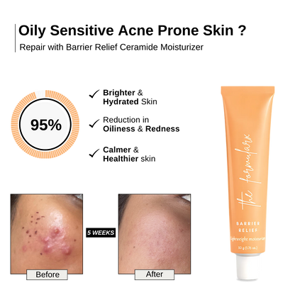 The_Formularx_Barrier_Relief_Lightweight_Ceramide_Moisturizer_before after results