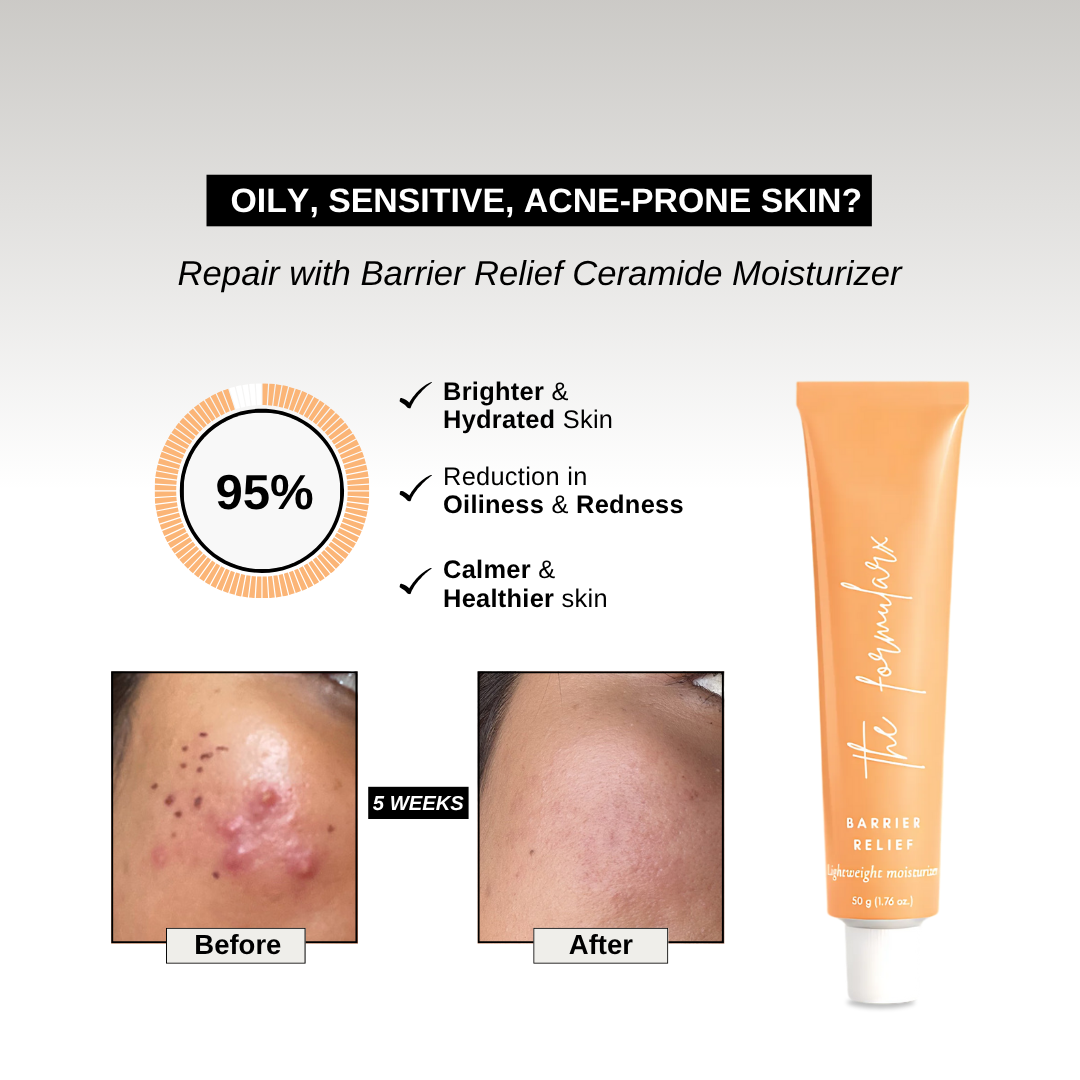 The Formularx Barrier Relief Lightweight Ceramide Moisturizer with Niacinamide that reduces skin sensitivity, redness, oiliness, and makes skin brighter