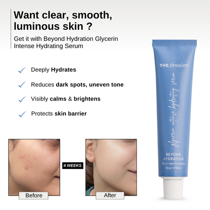 The Formularx Beyond Hydration Glycerin Intense Hydrating Serum hydrates, reduce dark spots, calms, brighten, and protect skin barrier