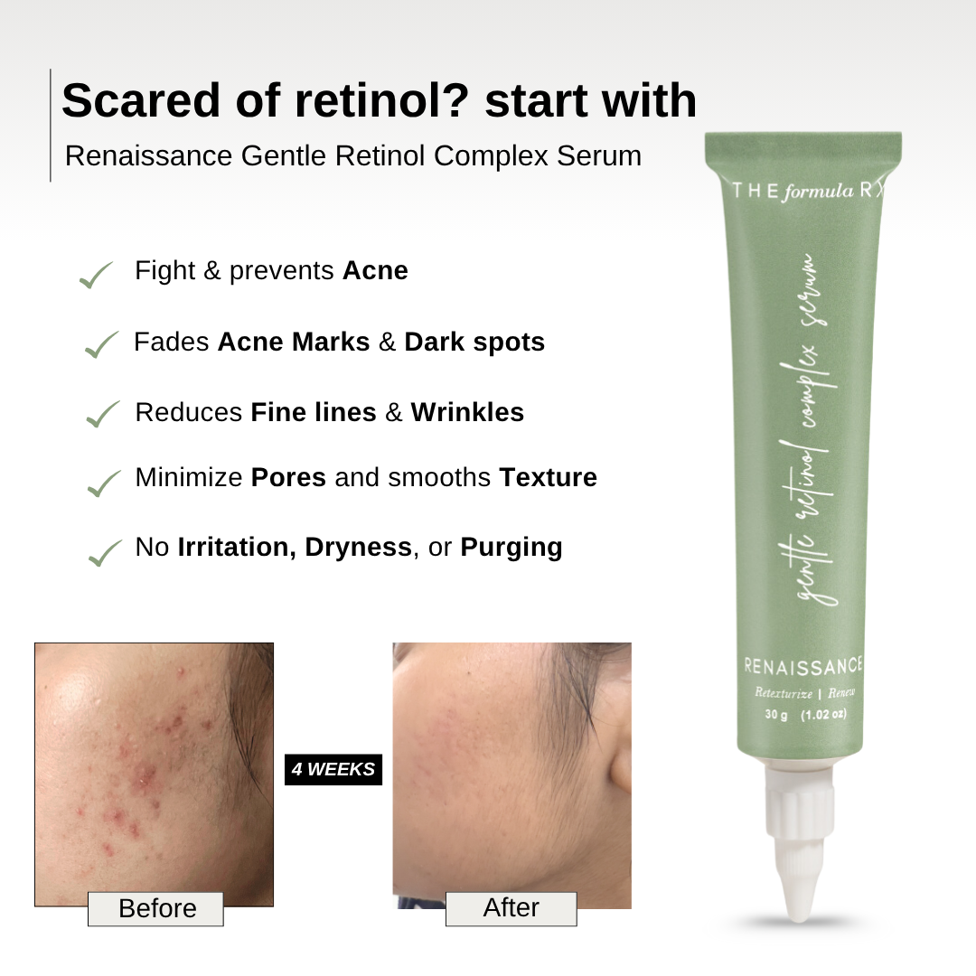 The Formularx Gentle Retinol Complex Serum reduce acne, acne marks, pigmentation and dark spots