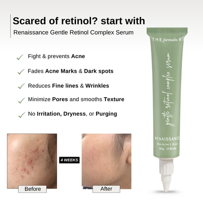 The Formularx Gentle Retinol Complex Serum reduce acne, acne marks, pigmentation and dark spots