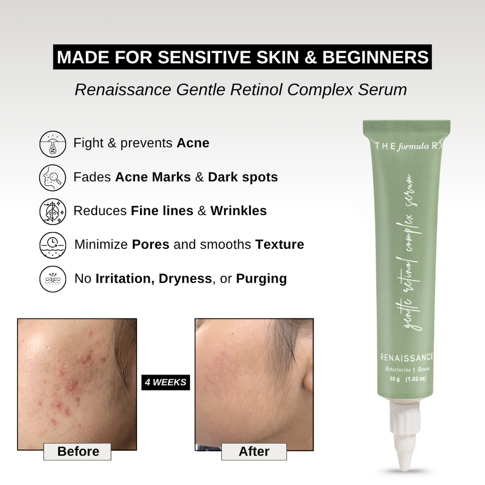 Gentle Retinol Complex Serum - Renaissance - For Acne & Acne Scars ...