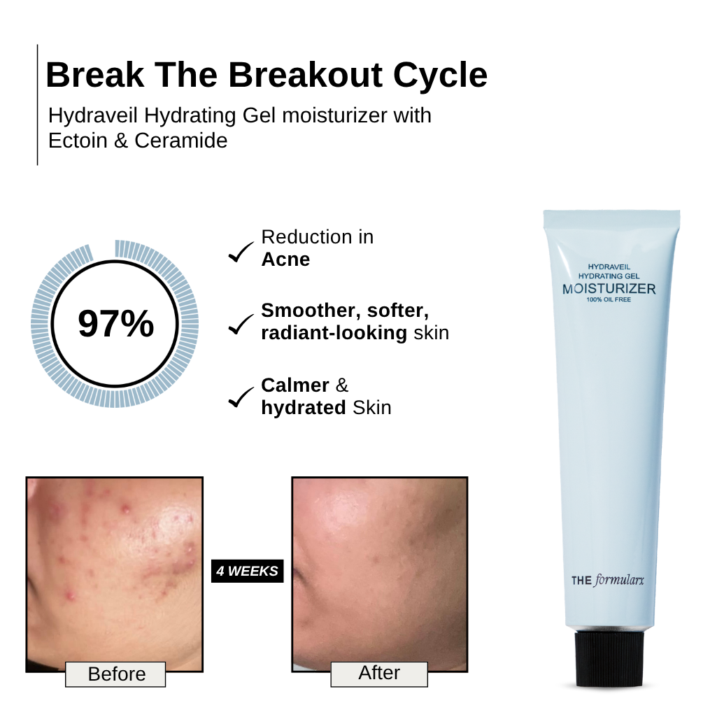 The Formularx Hydraveil Hydrating Ceramide Gel Moisturizer results