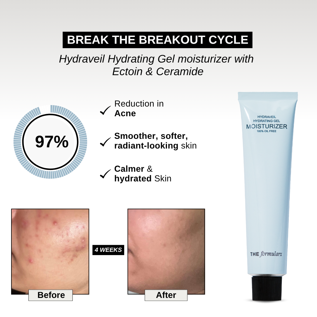 The Formularx Hydraveil Hydrating Ceramide Gel Moisturizer reduce skin sensitivity, hydrates skin, repairs skin barrier