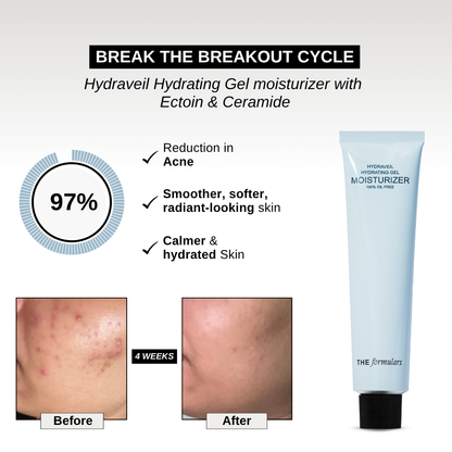 The Formularx Hydraveil Hydrating Ceramide Gel Moisturizer reduce skin sensitivity, hydrates skin, repairs skin barrier