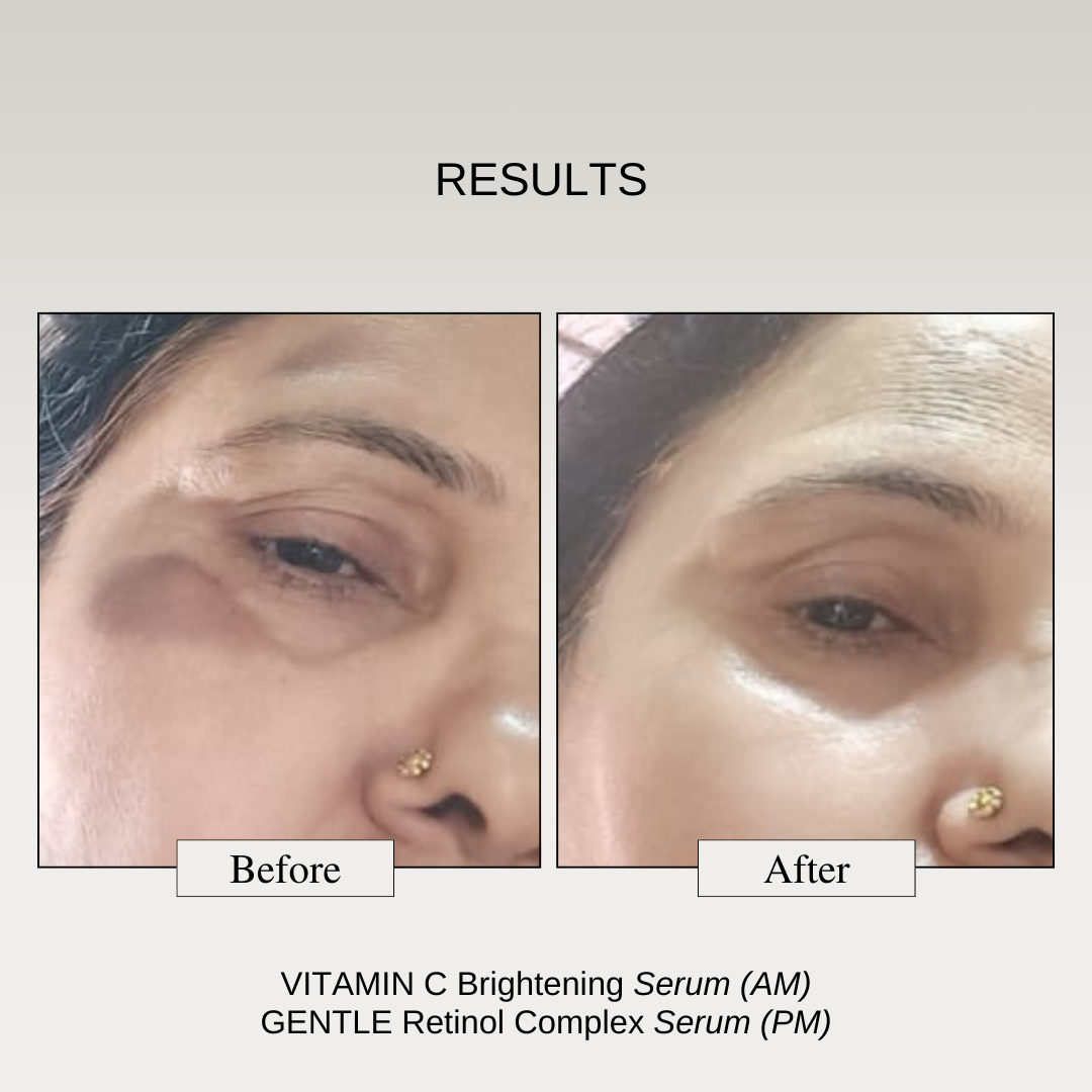 The Formularx Vitamin C Brightening Serum results