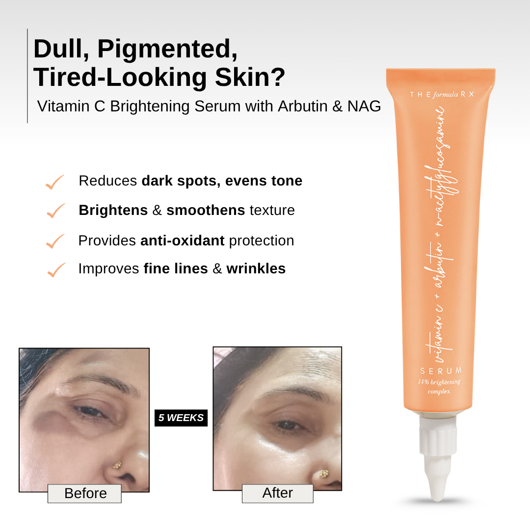 The Formularx Vitamin C Brightening Serum with Arbutin & Nag reduces dark spots and pigmentation, improve fine lines and wrinkles