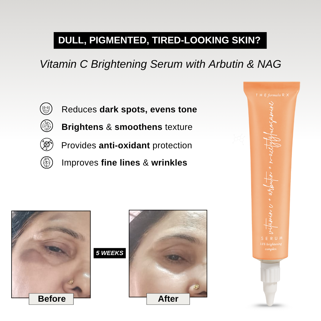 The Formularx Vitamin C Brightening Serum with Arbutin to reduce dark spots, brighten skin, reduce wrinkles and fine lines.