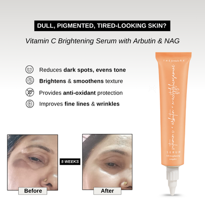 The Formularx Vitamin C Brightening Serum with Arbutin to reduce dark spots, brighten skin, reduce wrinkles and fine lines.
