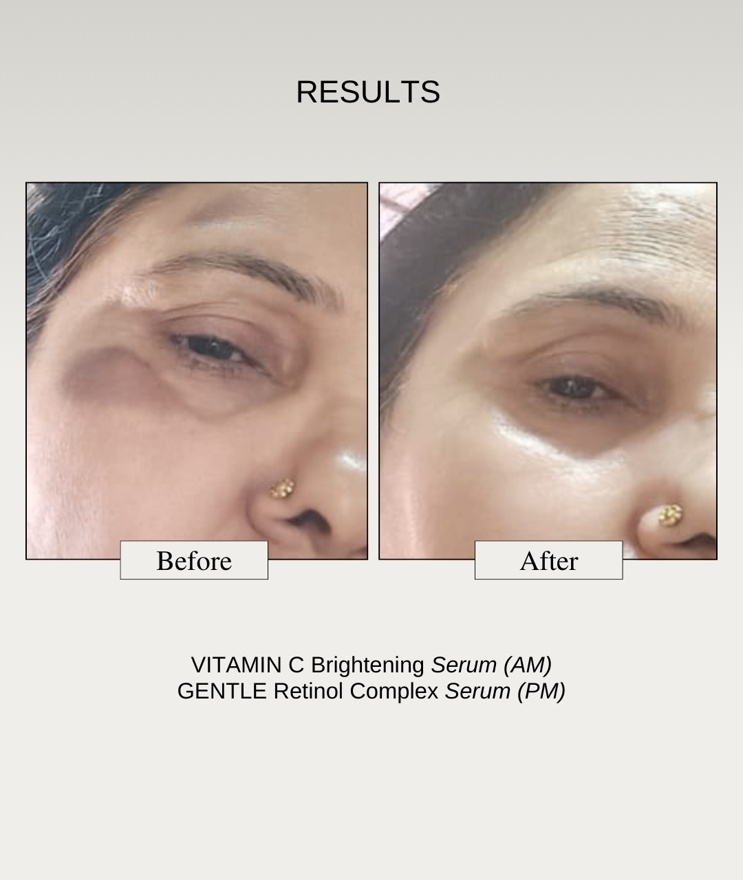 The Formularx Vitamin C Brightening multi-active Serum results